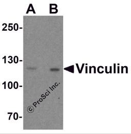Western blot analysis of Vinculin in PC-3 cell lysate with Vinculin antibody at (A) 1 and (B) 2 μg/ml.