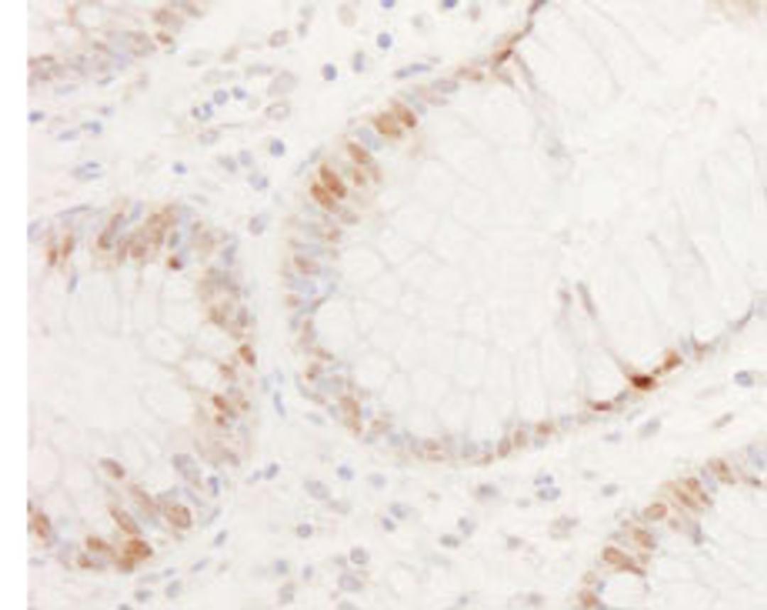 Detection of human CDX2 by immunohistochemistry.