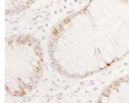 Detection of human CDX2 by immunohistochemistry.