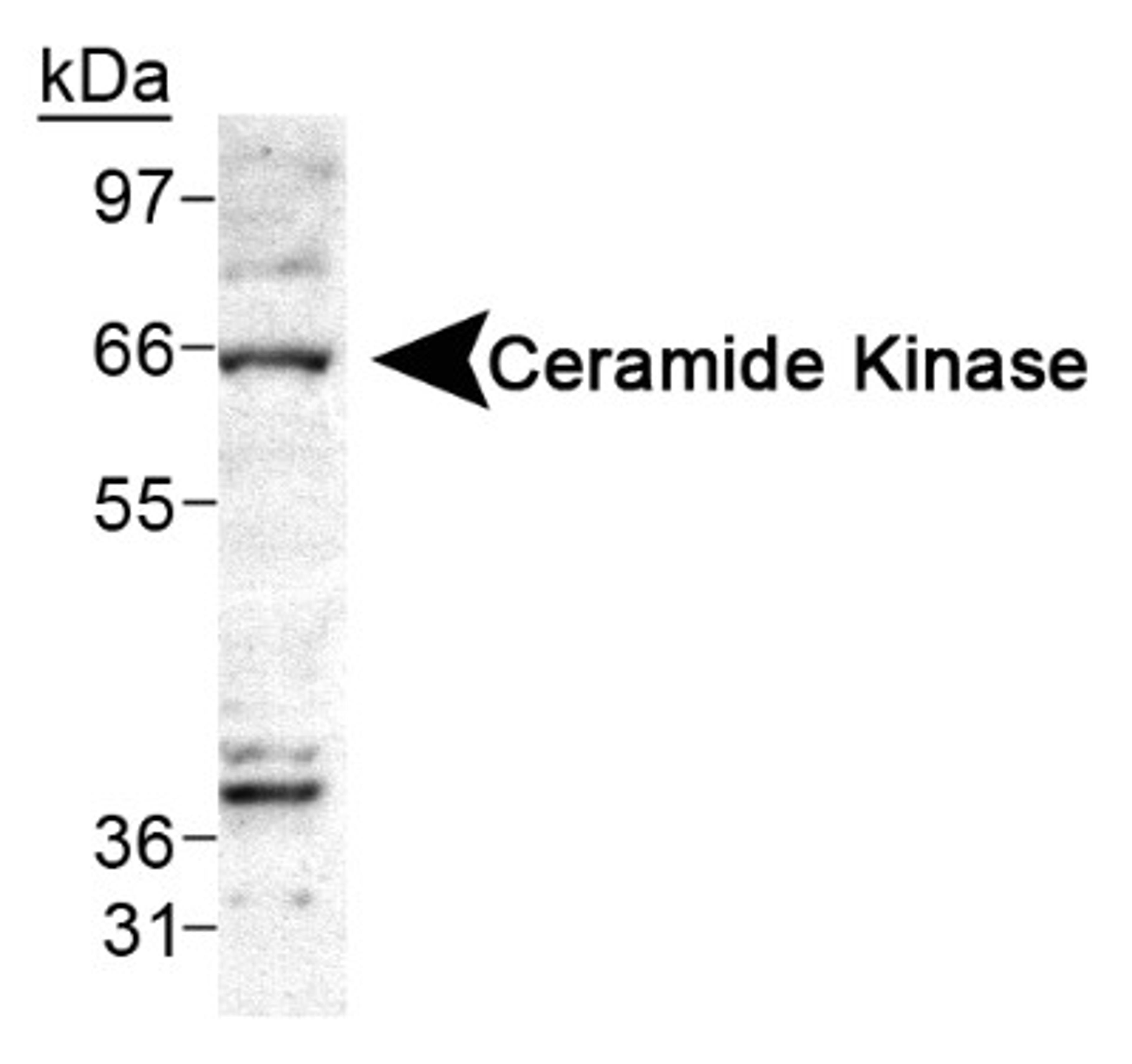 Western Blot: Ceramide Kinase Antibody [NB100-2911] - Detection of Ceramide Kinase in A549 cell lysate using NB 100-2911.