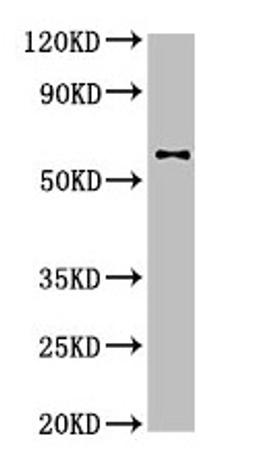 Western Blot. Positive WB detected in: U87 whole cell lysate. All lanes: DPYSL2 antibody at 4µg/ml. Secondary. Goat polyclonal to rabbit IgG at 1/50000 dilution. Predicted band size: 63, 59 kDa. Observed band size: 63 kDa