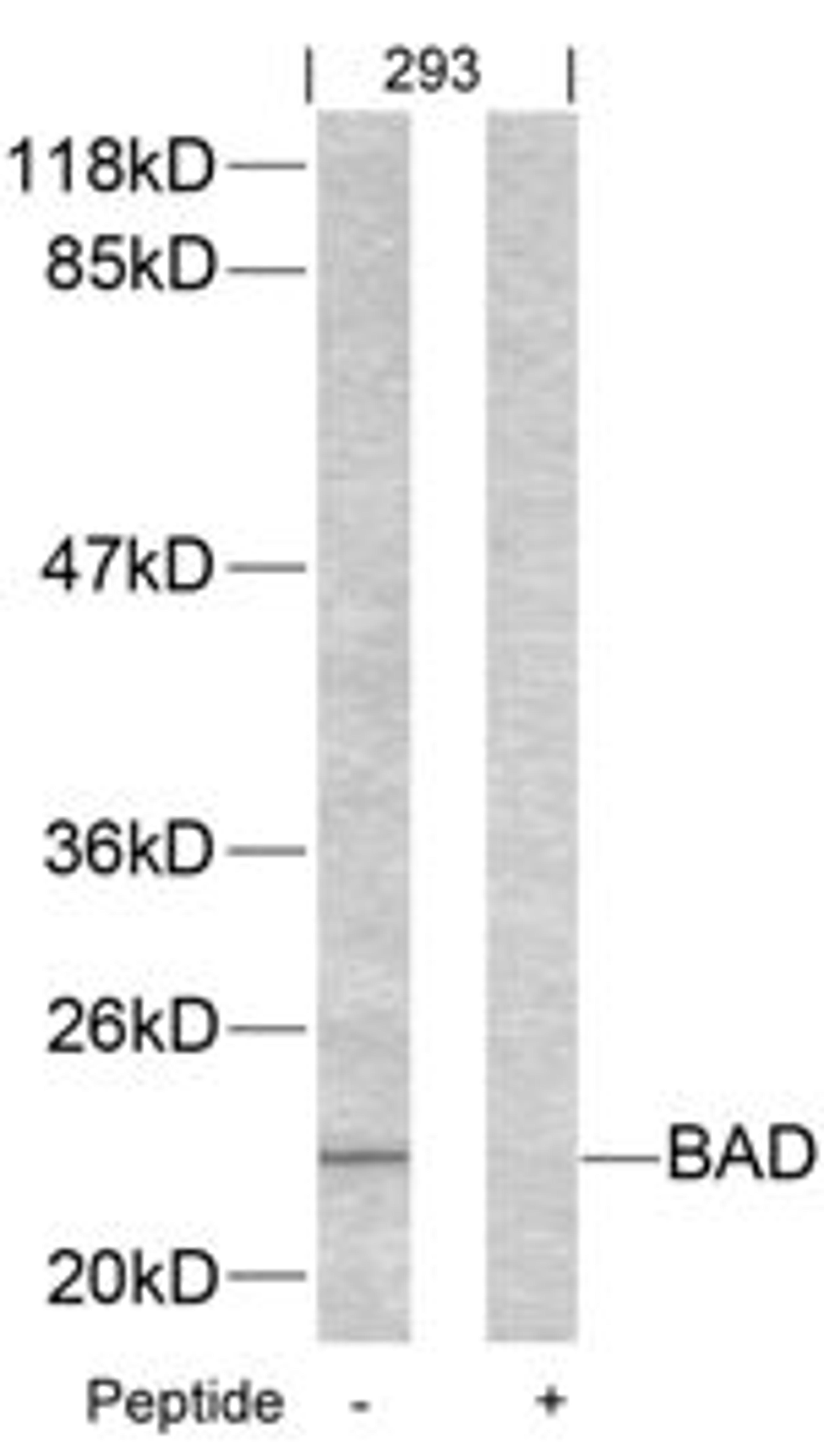 Western blot analysis of lysed extracts from 293 cells using BAD (Ab-155).