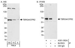 Detection of human TBRG4/CPR2 by western blot and immunoprecipitation.