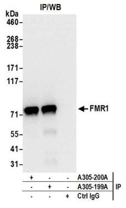 Detection of human FMR1 by western blot of immunoprecipitates.