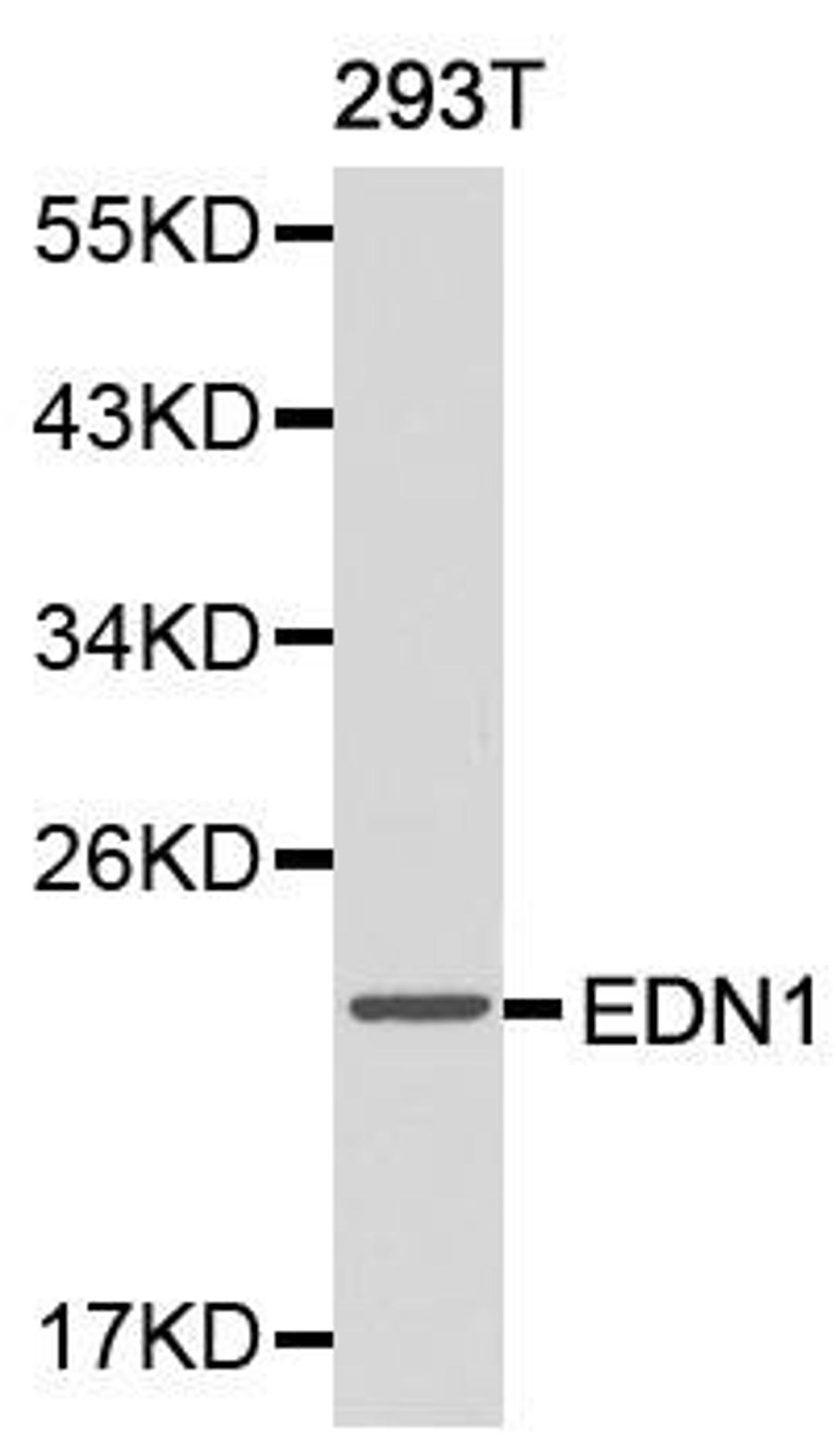 Western blot analysis of 293T cell lysate using EDN1 antibody