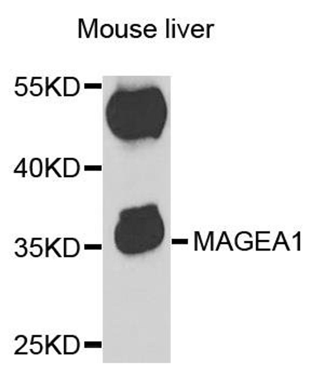 Western blot analysis of extracts of mouse liver using MAGEA1 antibody