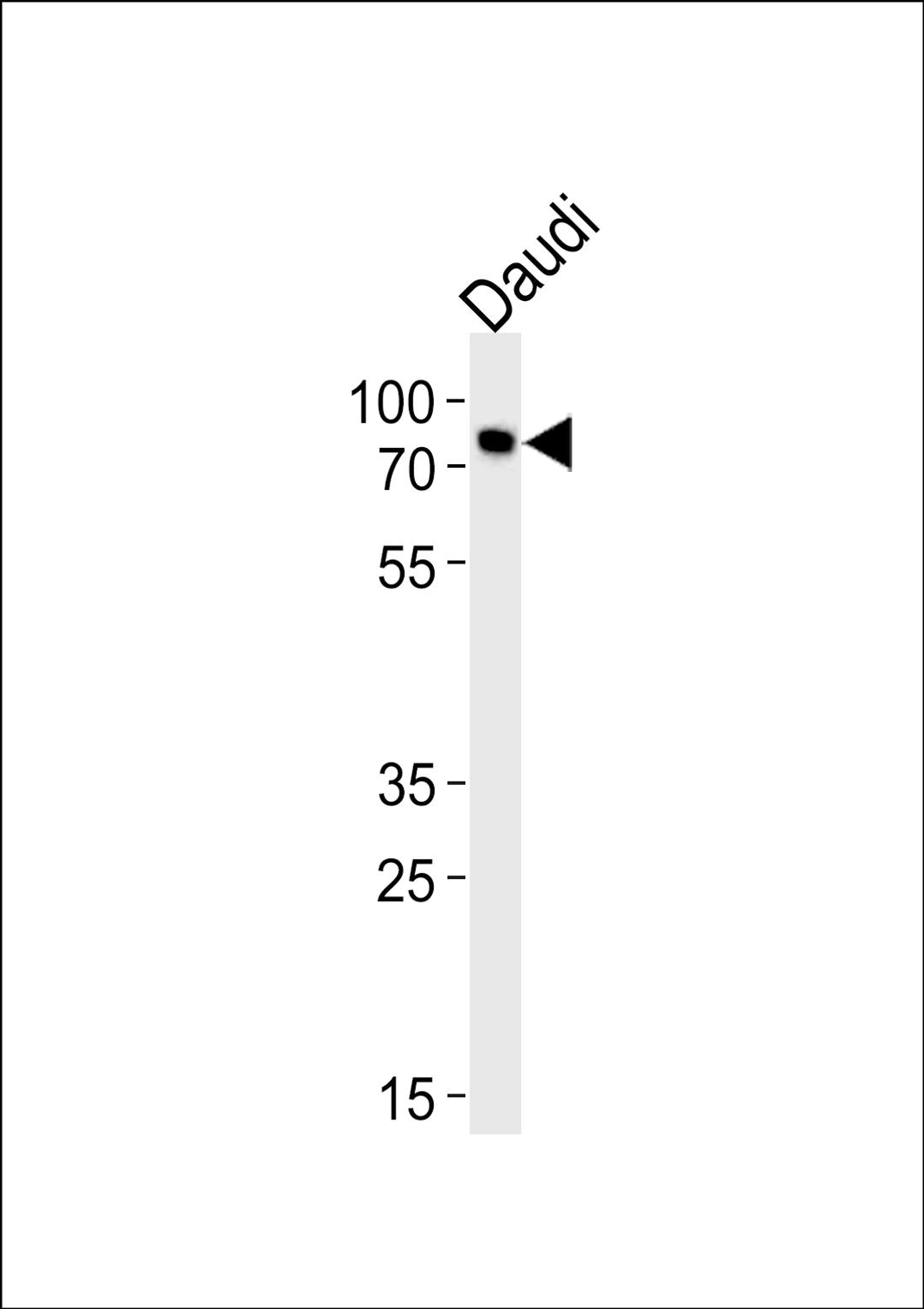 Western blot analysis of lysate from Daudi cell line, using C-rel (NFkB)-G601 Antibody at 1:1000 at each lane.