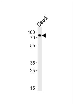 Western blot analysis of lysate from Daudi cell line, using C-rel (NFkB)-G601 Antibody at 1:1000 at each lane.