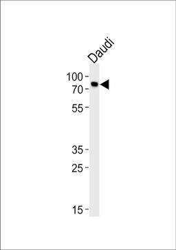 Western blot analysis of lysate from Daudi cell line, using C-rel (NFkB)-G601 Antibody at 1:1000 at each lane.