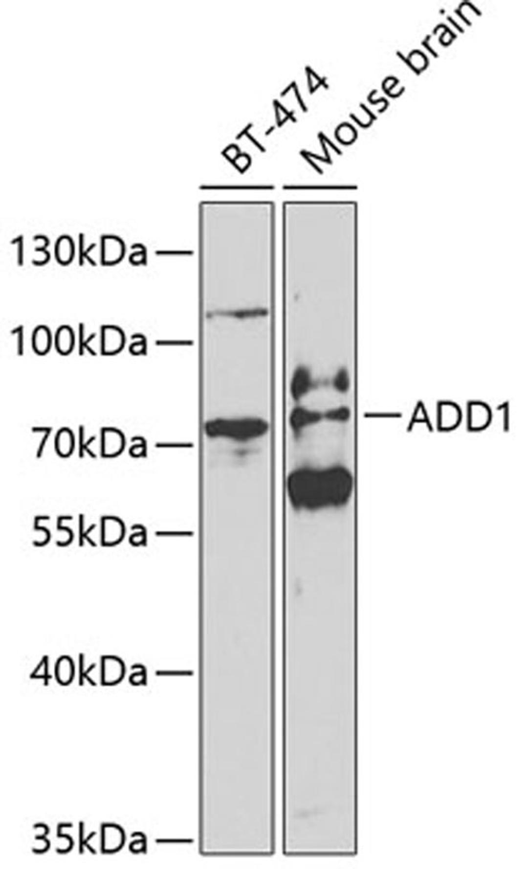 Western blot - ADD1 antibody (A1592)