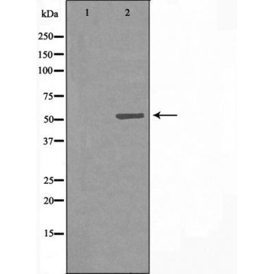 Western blot analysis of LOVO cells using 7B1 (Cytochrome P450) antibody