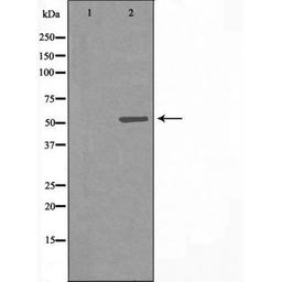 Western blot analysis of LOVO cells using 7B1 (Cytochrome P450) antibody