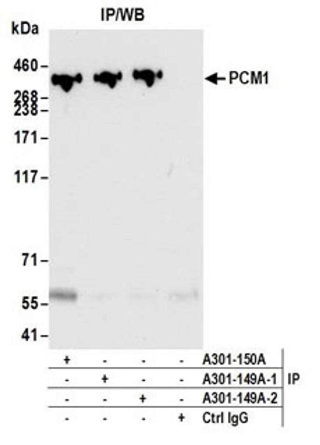 Detection of human PCM1 by western blot of immunoprecipitates.