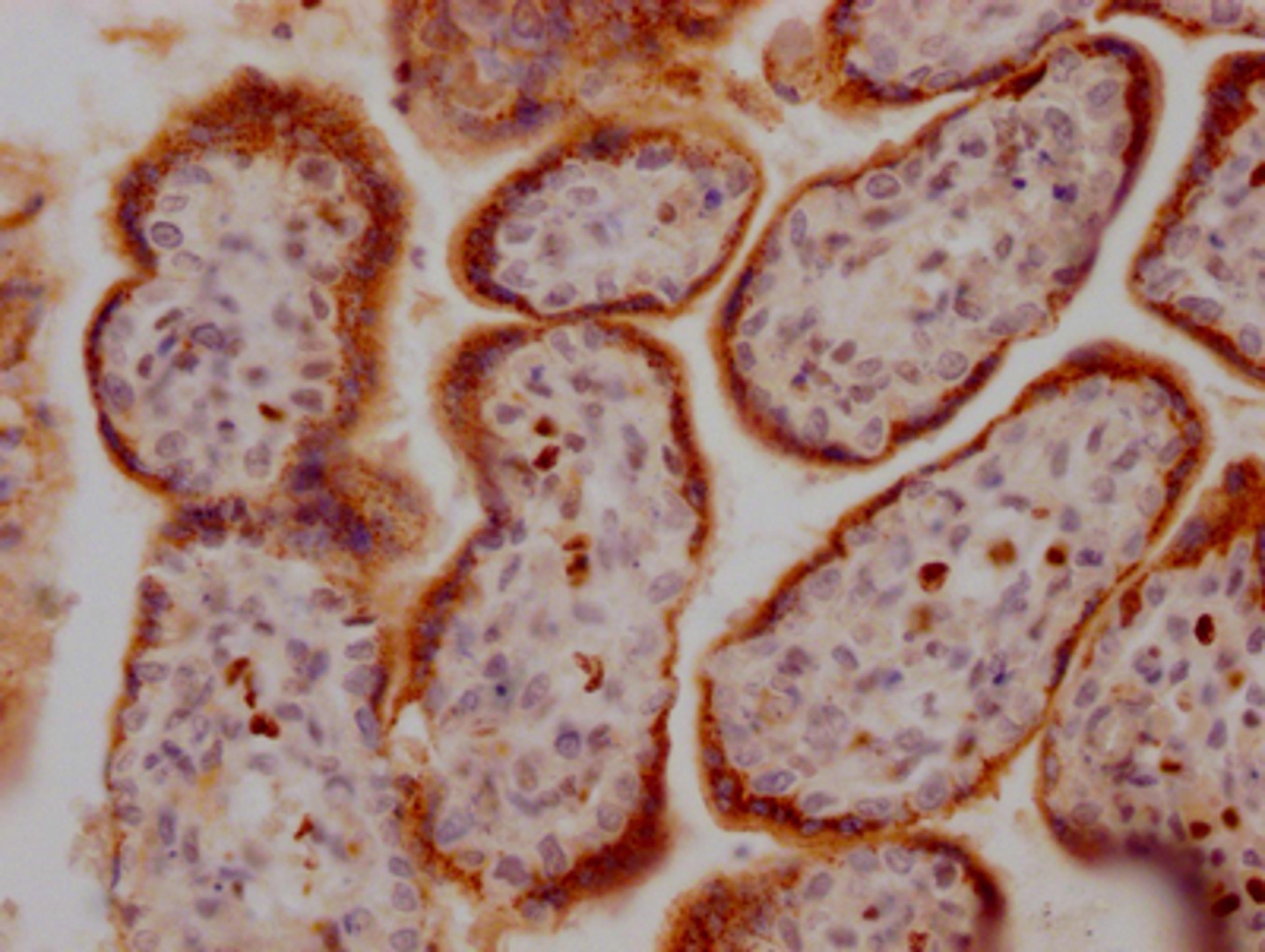 IHC image of CSB-RA285852A0HU diluted at 1:100 and staining in paraffin-embedded human placenta tissue performed on a Leica BondTM system. After dewaxing and hydration, antigen retrieval was mediated by high pressure in a citrate buffer (pH 6.0). Section was blocked with 10% normal goat serum 30min at RT. Then primary antibody (1% BSA) was incubated at 4℃ overnight. The primary is detected by a Goat anti-rabbit IgG polymer labeled by HRP and visualized using 0.05% DAB.