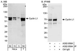 Detection of human Cyclin L1 by western blot and immunoprecipitation.