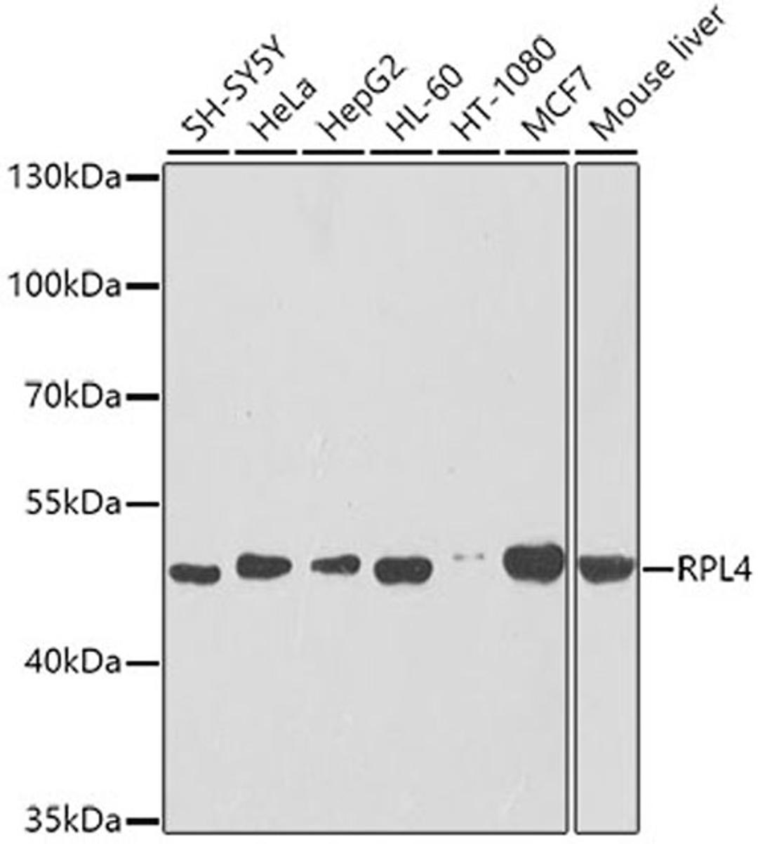 Western blot - RPL4 antibody (A5886)