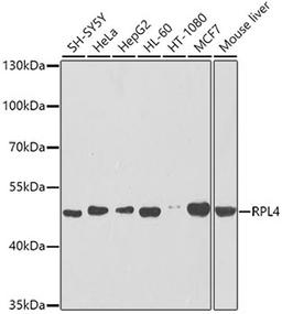 Western blot - RPL4 antibody (A5886)