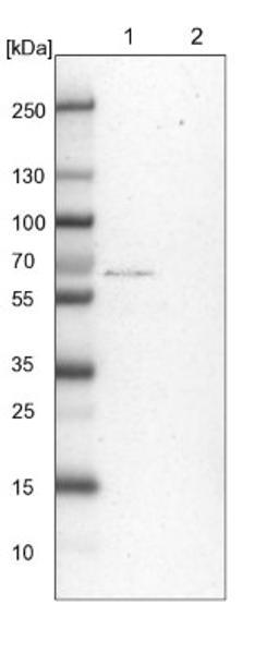 Western Blot: FIP1L1 Antibody [NBP1-85064] - Lane 1: NIH-3T3 cell lysate (Mouse embryonic fibroblast cells)<br/>Lane 2: NBT-II cell lysate (Rat Wistar bladder tumour cells)