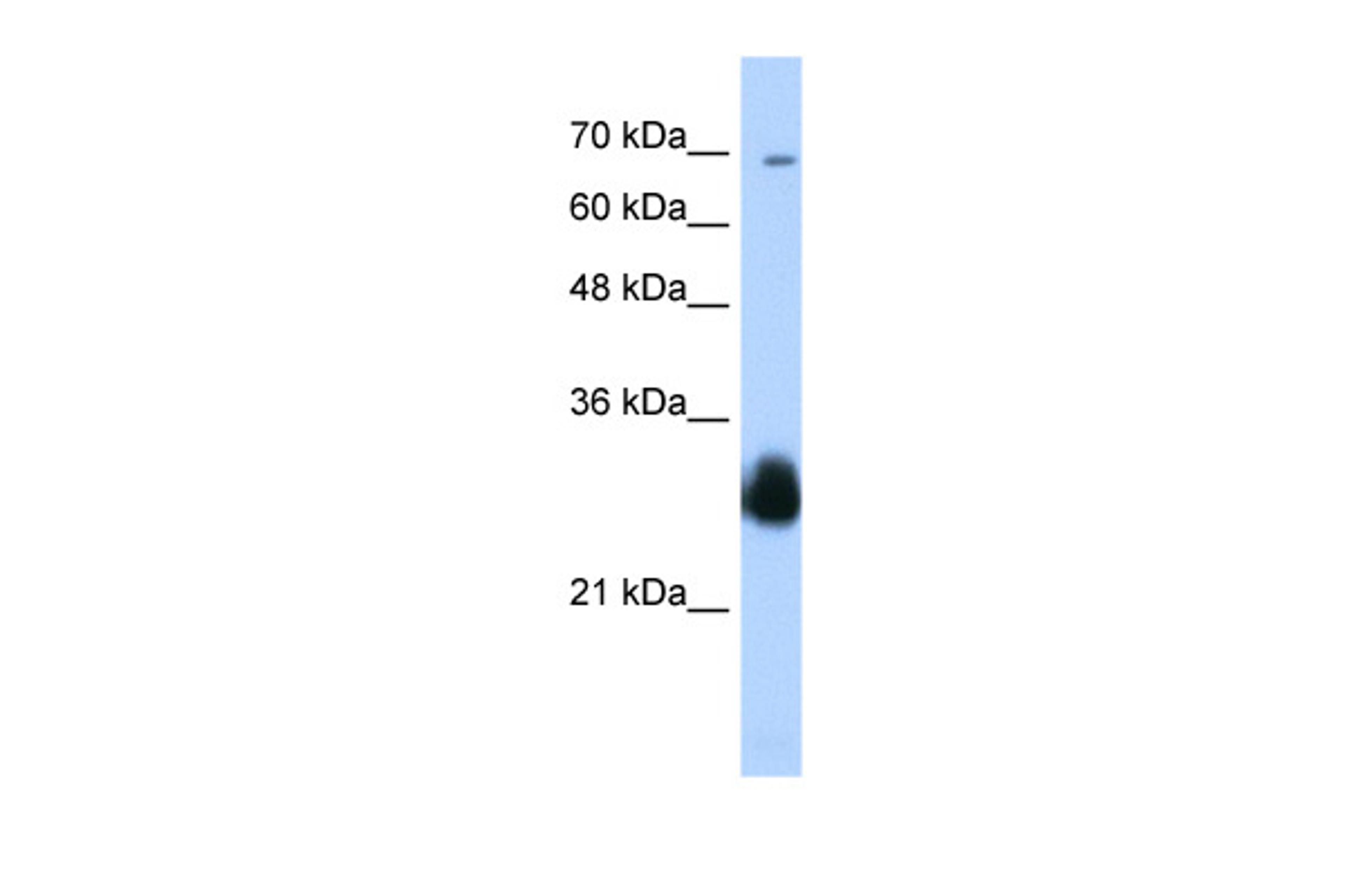 Antibody used in WB on Transfected 293T at 0.2-1 ug/ml.