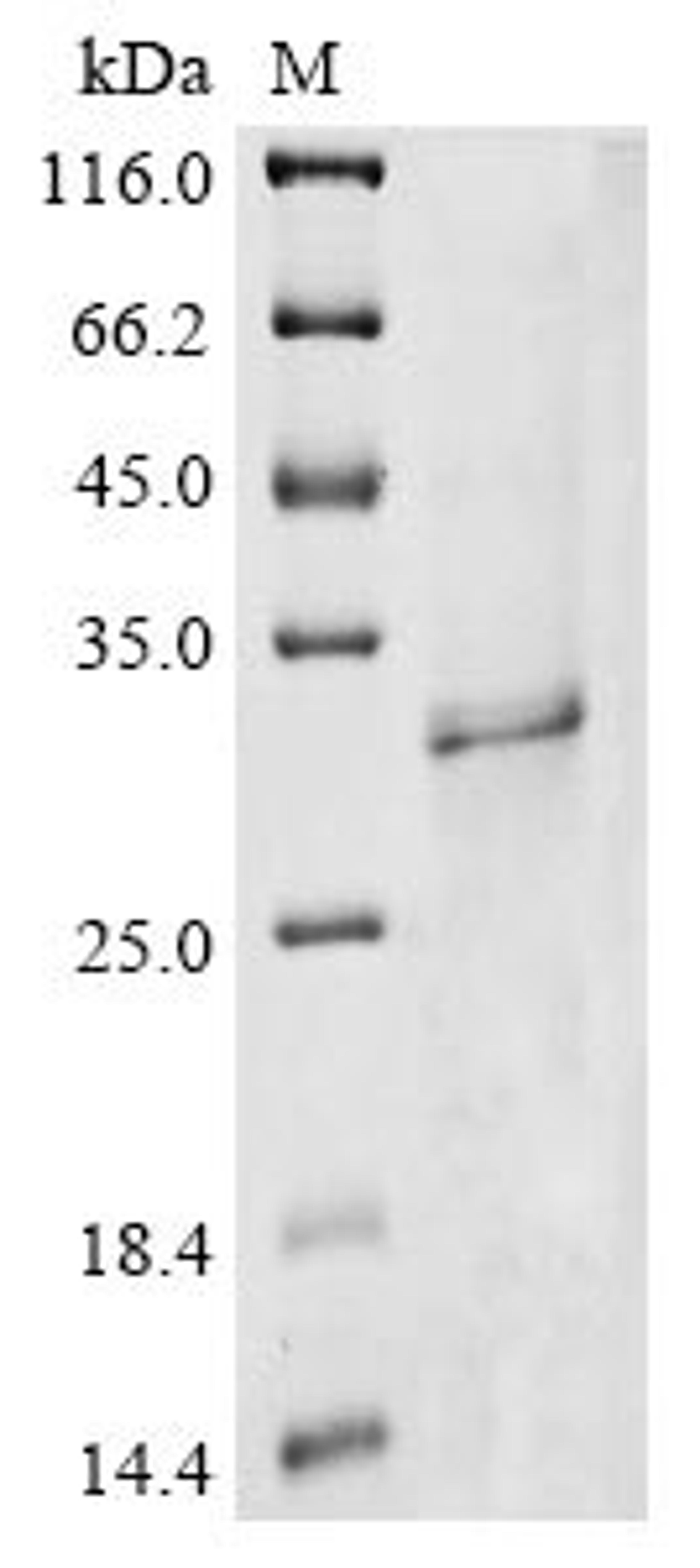 (Tris-Glycine gel) Discontinuous SDS-PAGE (reduced) with 5% enrichment gel and 15% separation gel.