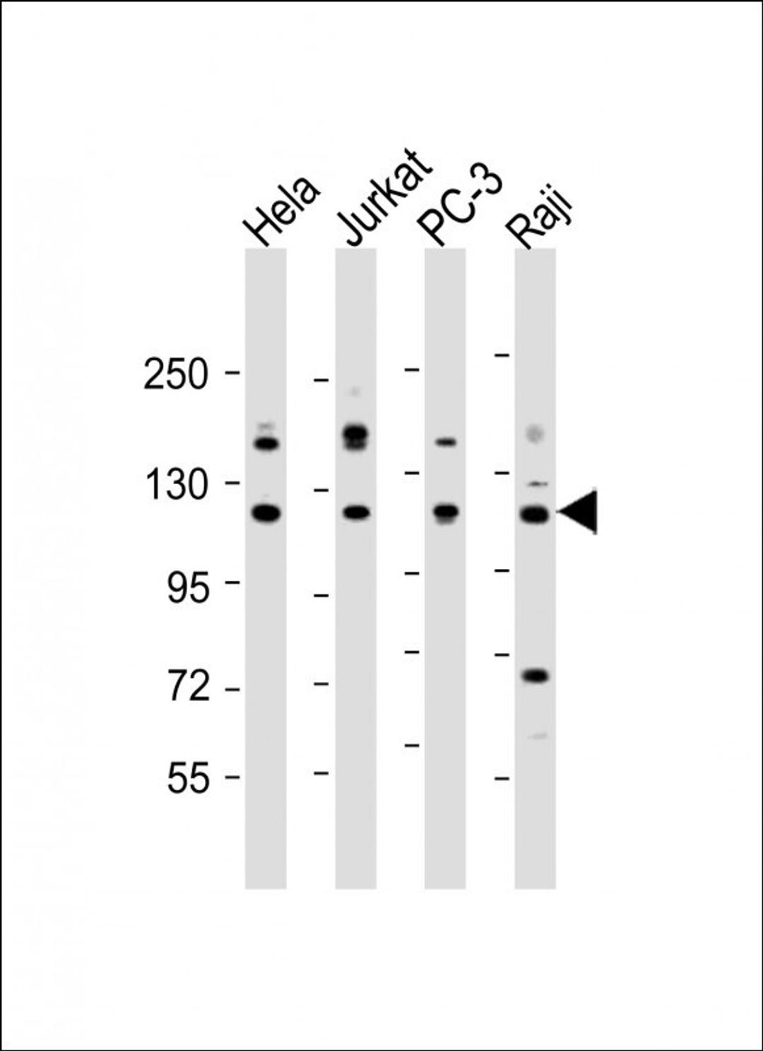 Western Blot at 1:2000 dilution Lane 1: Hela whole cell lysate Lane 2: Jurkat whole cell lysate Lane 3: PC-3 whole cell lysate Lane 4: Raji whole cell lysate Lysates/proteins at 20 ug per lane.