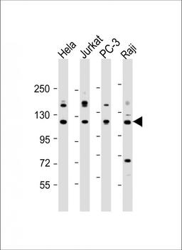 Western Blot at 1:2000 dilution Lane 1: Hela whole cell lysate Lane 2: Jurkat whole cell lysate Lane 3: PC-3 whole cell lysate Lane 4: Raji whole cell lysate Lysates/proteins at 20 ug per lane.