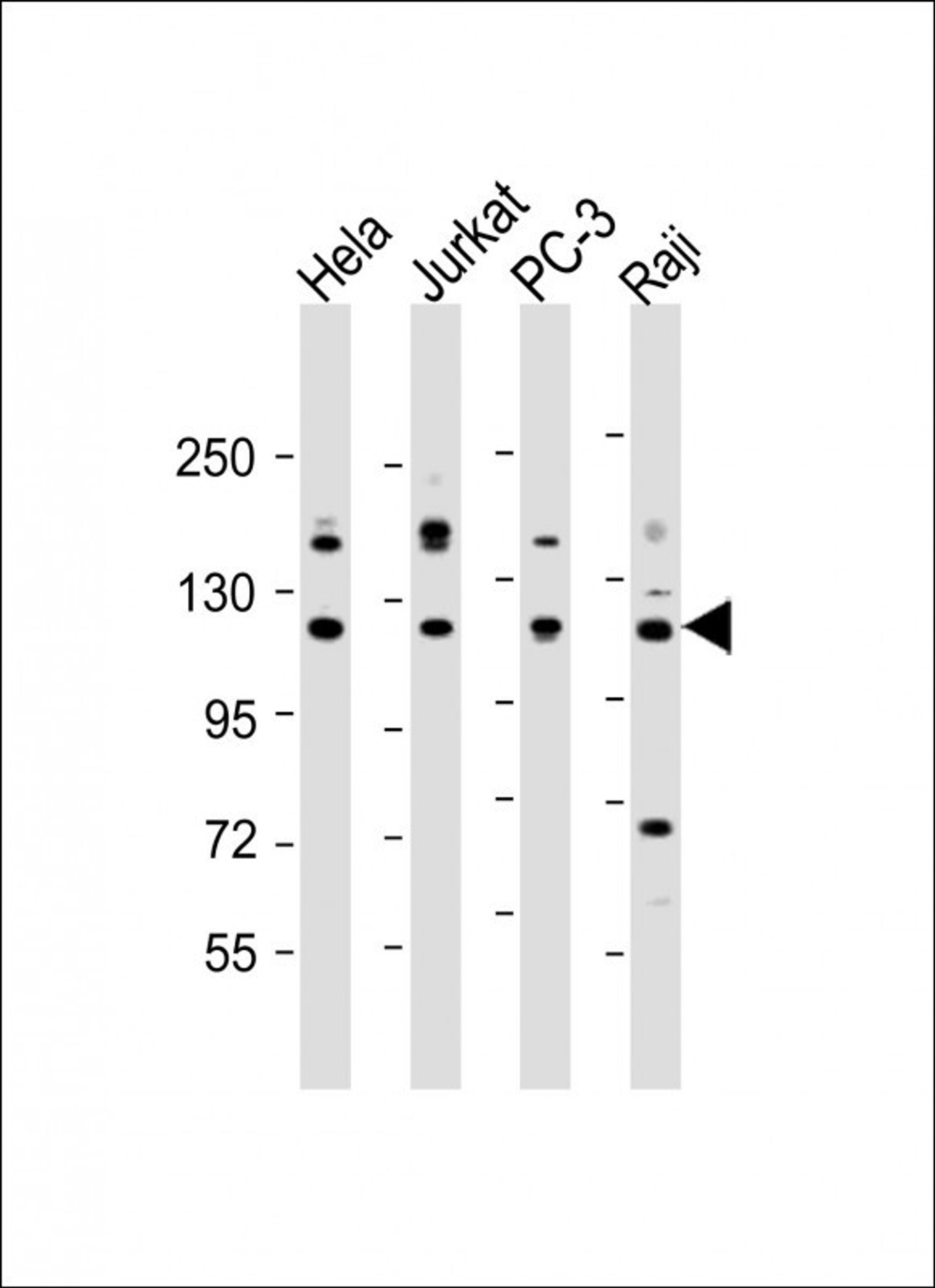 Western Blot at 1:2000 dilution Lane 1: Hela whole cell lysate Lane 2: Jurkat whole cell lysate Lane 3: PC-3 whole cell lysate Lane 4: Raji whole cell lysate Lysates/proteins at 20 ug per lane.