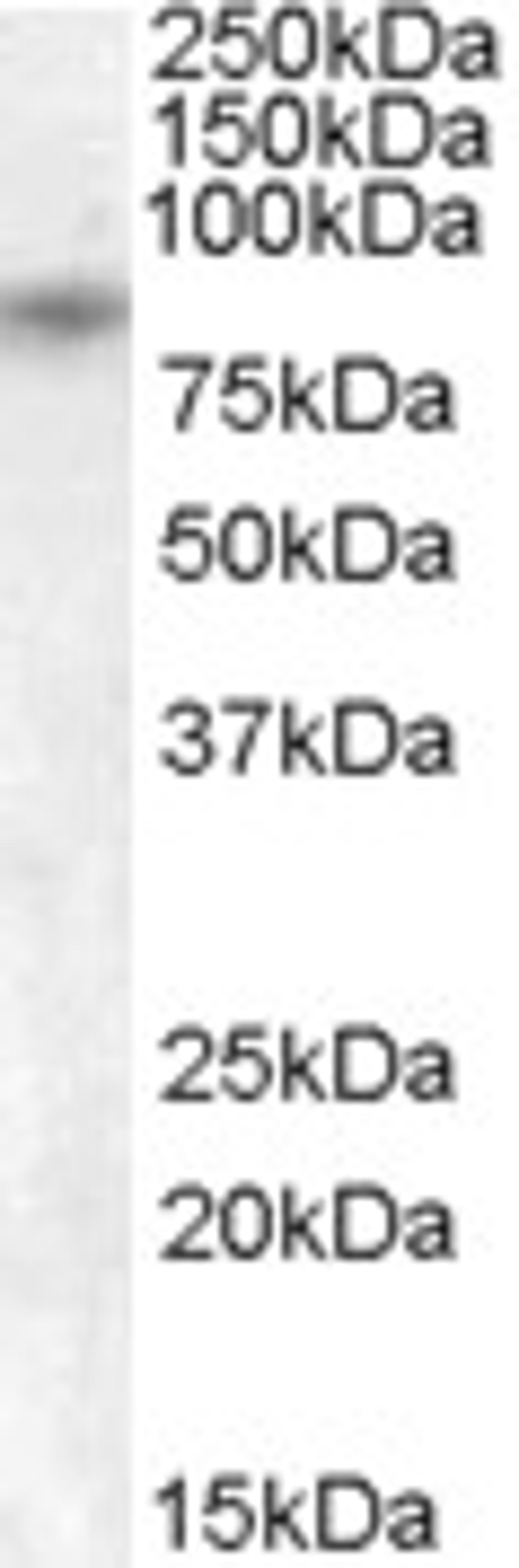 46-533 (1ug/ml) staining of Human Pancreas lysate (35ug protein in RIPA buffer). Primary incubation was 1 hour. Detected by chemiluminescence.