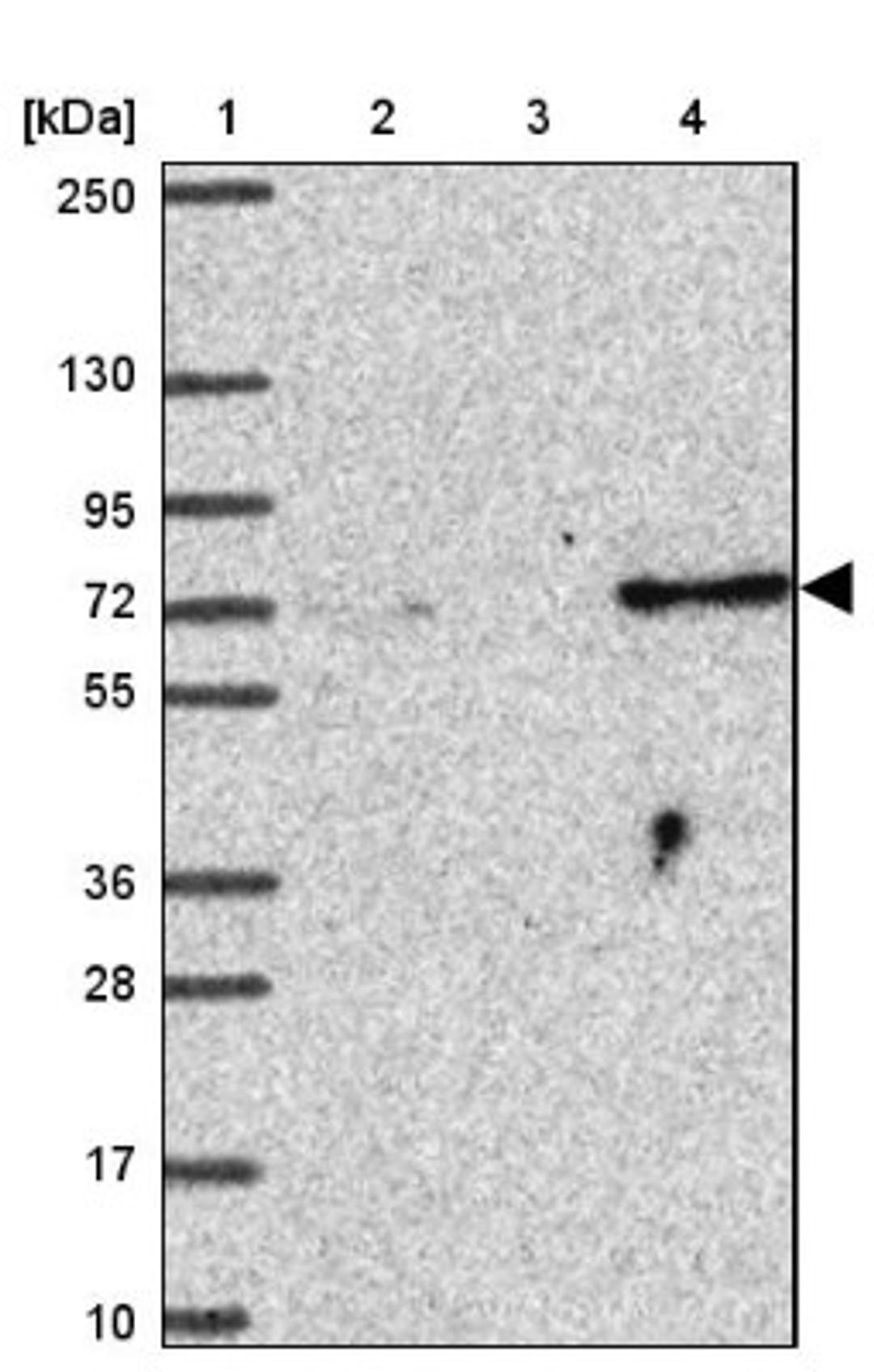 Western Blot: SUZ12 Antibody [NBP2-33834] - Lane 1: Marker [kDa] 250, 130, 95, 72, 55, 36, 28, 17, 10<br/>Lane 2: Human cell line RT-4<br/>Lane 3: Human cell line U-251MG sp<br/>Lane 4: Human plasma (IgG/HSA depleted)