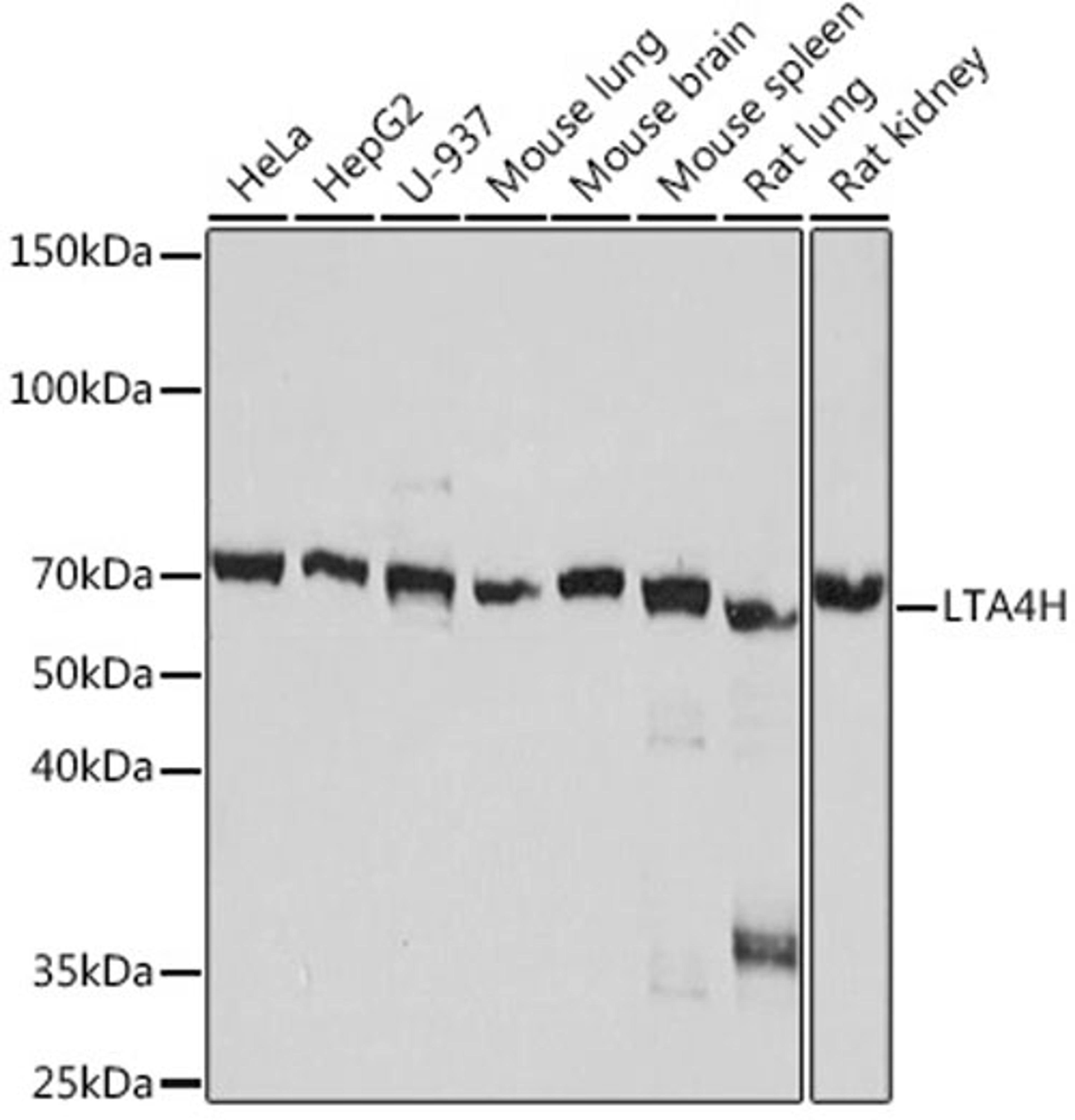 Western blot - LTA4H Rabbit mAb (A8918)