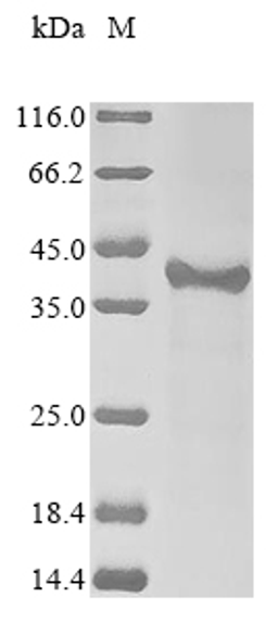 (Tris-Glycine gel) Discontinuous SDS-PAGE (reduced) with 5% enrichment gel and 15% separation gel.