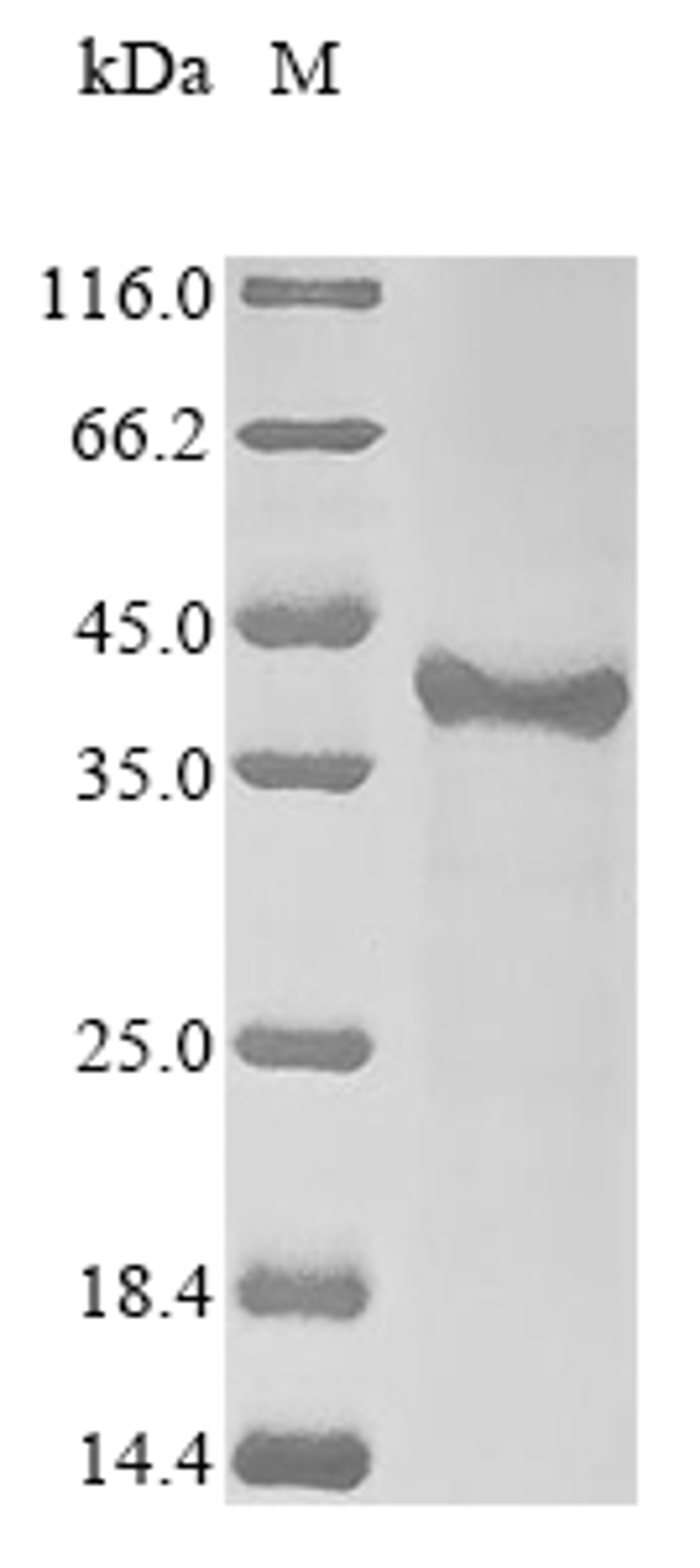 (Tris-Glycine gel) Discontinuous SDS-PAGE (reduced) with 5% enrichment gel and 15% separation gel.
