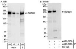 Detection of human ROBO1 by western blot and immunoprecipitation.