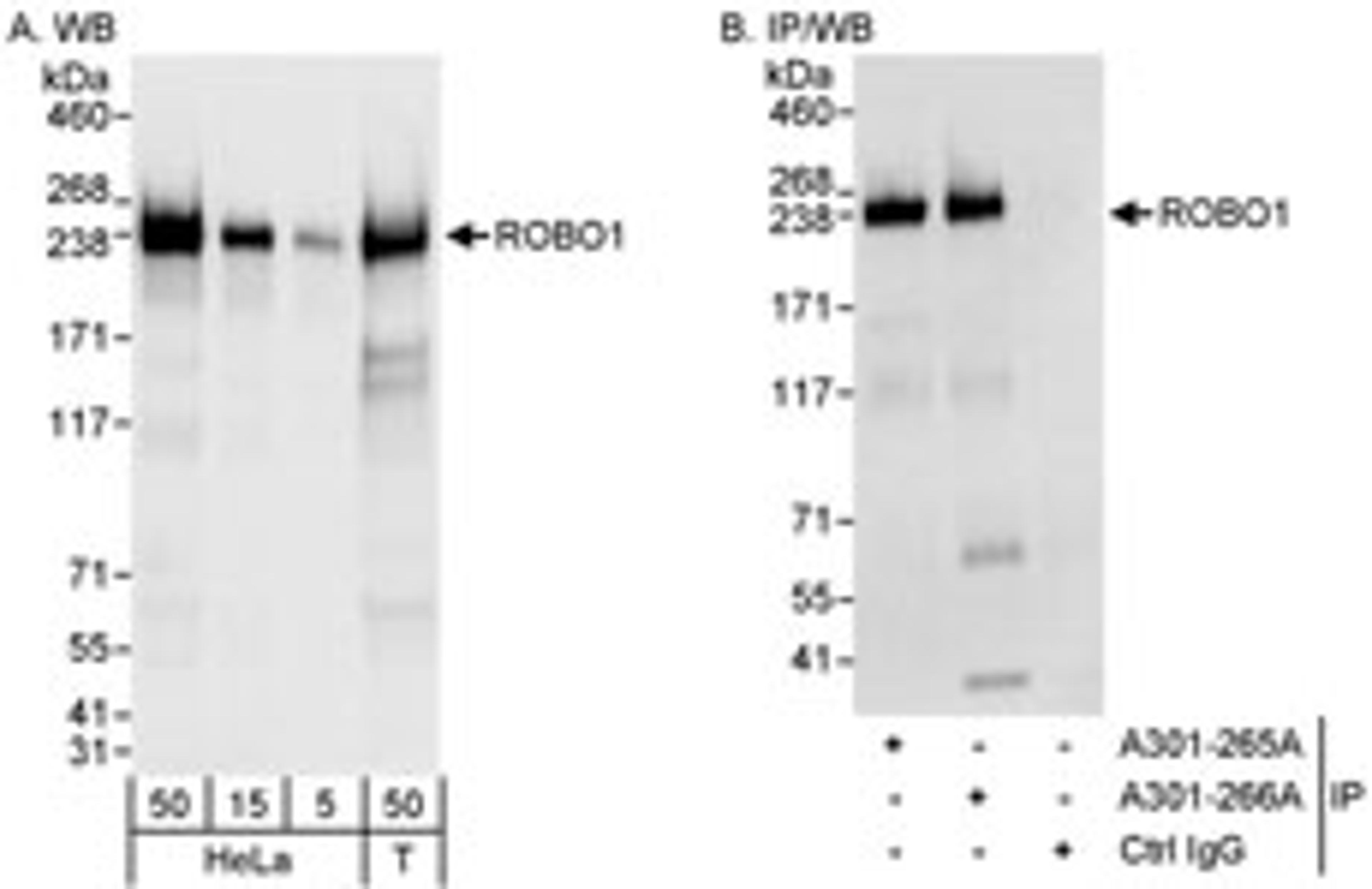 Detection of human ROBO1 by western blot and immunoprecipitation.