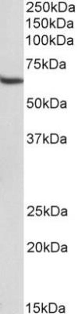 Western Blot: STAM-1 Antibody (29C678) [NB100-56533] -  Western blot analysis of HeLa lysate (35ug per lane, RIPA buffer) using STAM antibody (NB100-56533) at 1ug/ml. Band observed at ~65kDA. (Expected MW of 59.2kDa according to NP_003464.1).