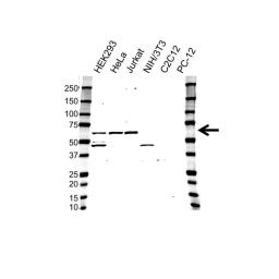 Western blot analysis of whole cell lysates probed with MAPK9 / JNK2 antibody