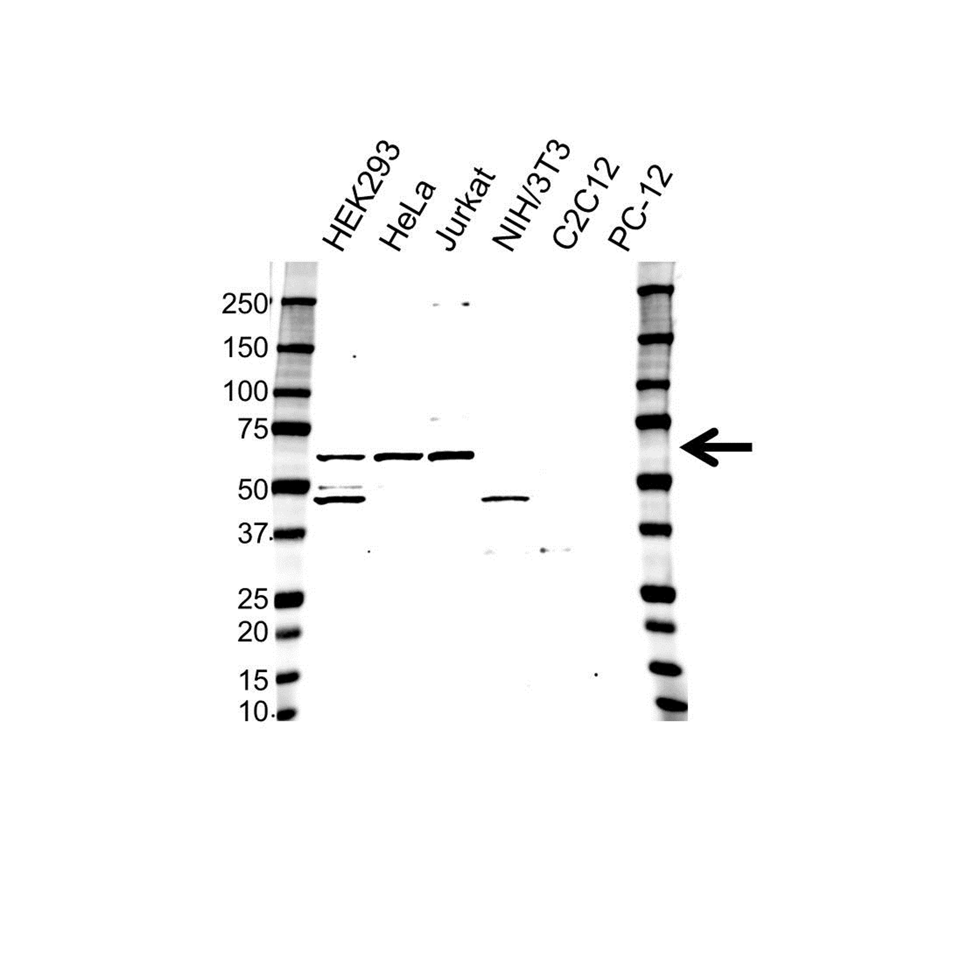 Western blot analysis of whole cell lysates probed with MAPK9 / JNK2 antibody