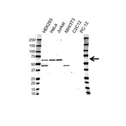 Western blot analysis of whole cell lysates probed with MAPK9 / JNK2 antibody