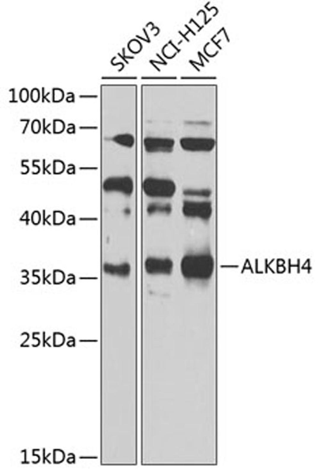 Western blot - ALKBH4 Antibody (A7812)