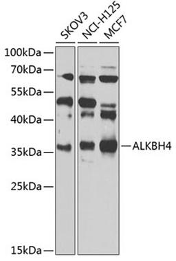 Western blot - ALKBH4 Antibody (A7812)