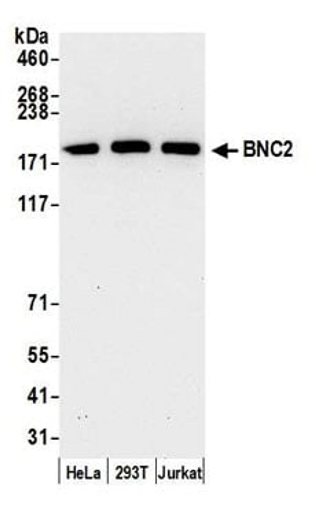 Detection of human BNC2 by western blot.