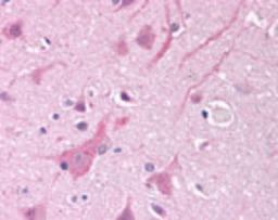 Immunohistochemistry-Paraffin: Nav1.5 Antibody [NB600-804] - IHC analysis of Nav1.5 in formalin-fixed, paraffin-embedded brain (cortex) using this antibody at 5-10 ug/ml.