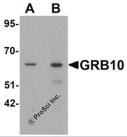 Western blot analysis of GRB10 in SK-N-SH cell lysate with GRB10 antibody at (A) 1 and (B) 2 &#956;g/mL.