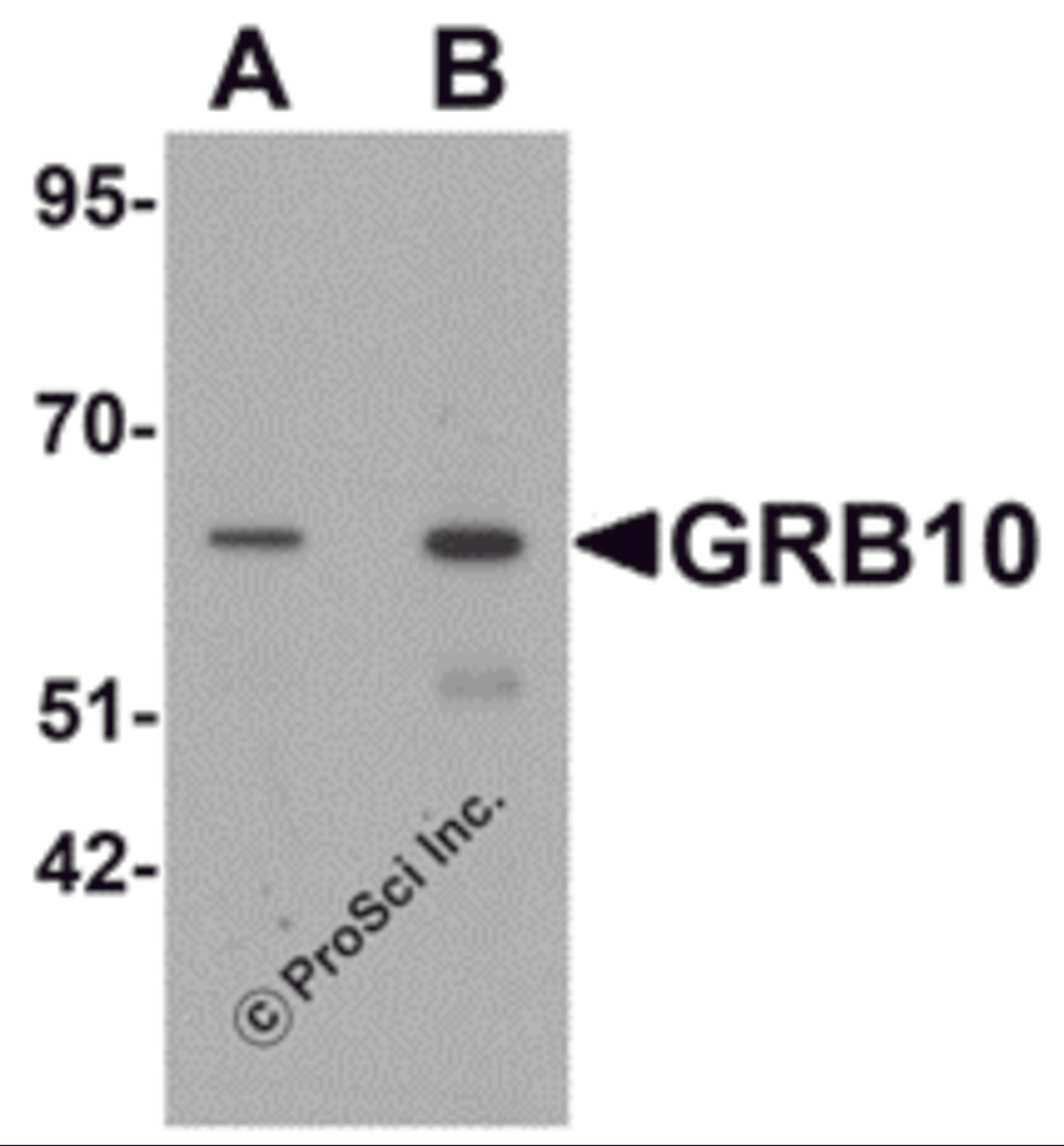 Western blot analysis of GRB10 in SK-N-SH cell lysate with GRB10 antibody at (A) 1 and (B) 2 &#956;g/mL.