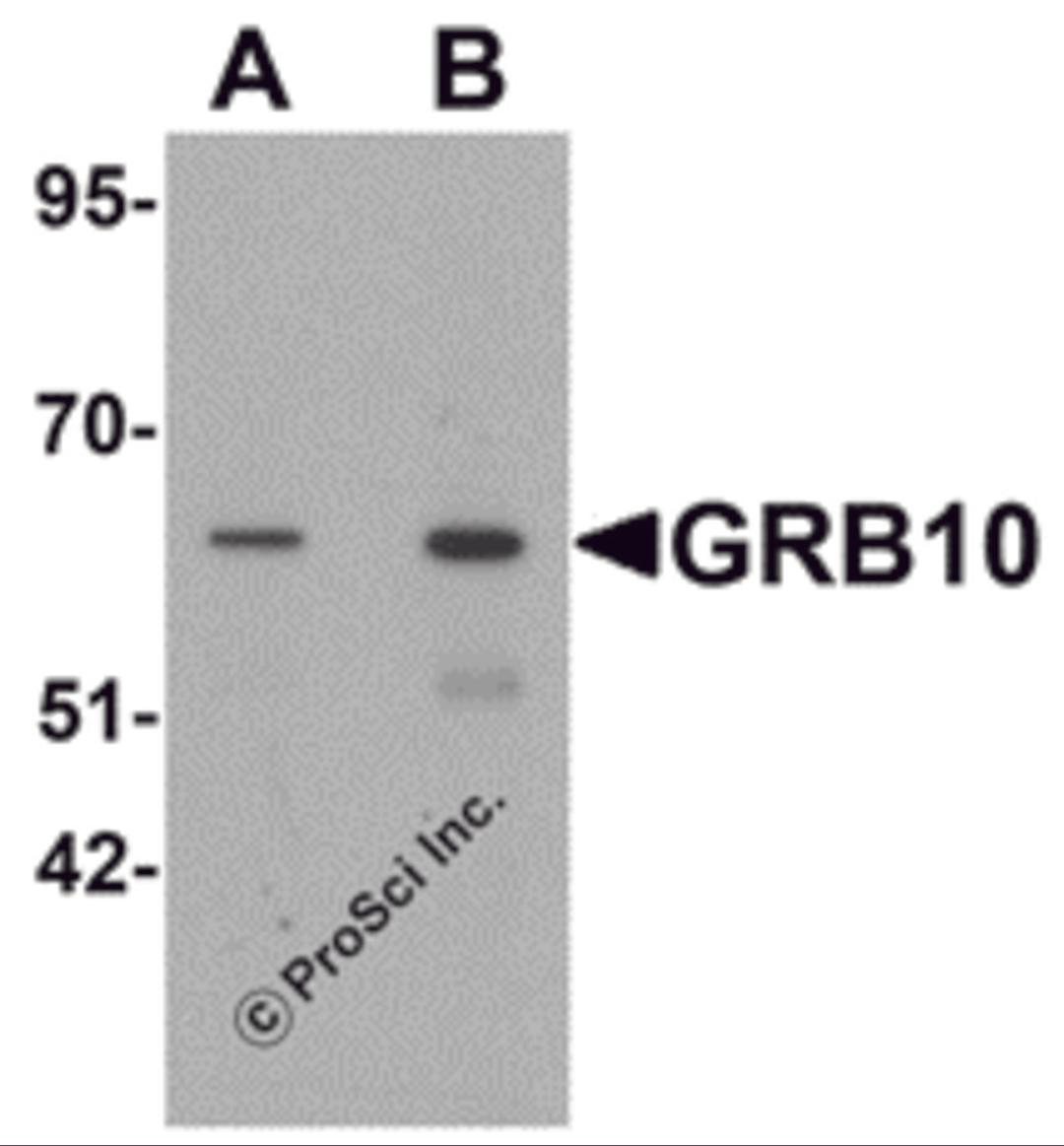 Western blot analysis of GRB10 in SK-N-SH cell lysate with GRB10 antibody at (A) 1 and (B) 2 μg/mL.