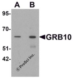 Western blot analysis of GRB10 in SK-N-SH cell lysate with GRB10 antibody at (A) 1 and (B) 2 μg/mL.