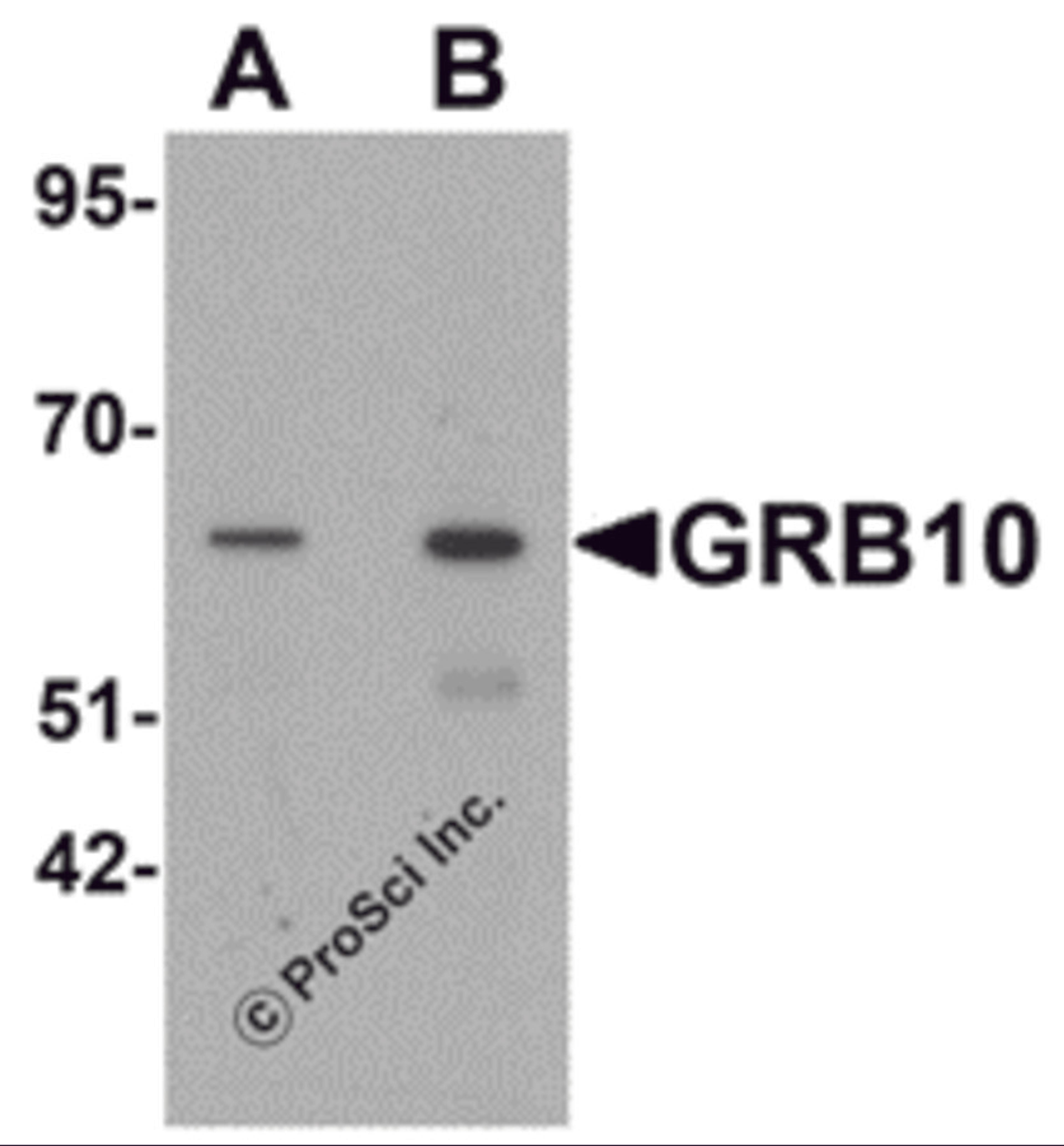 Western blot analysis of GRB10 in SK-N-SH cell lysate with GRB10 antibody at (A) 1 and (B) 2 μg/mL.