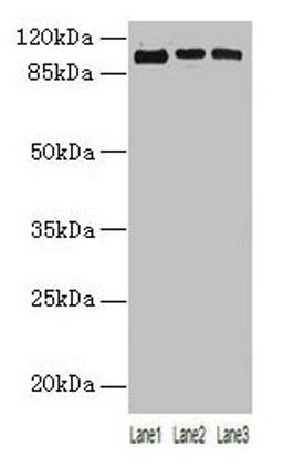 Western blot. All lanes: ZNF546 antibody at 4µg/ml. Lane 1: A549 whole cell lysate. Lane 2: 293T whole cell lysate. Lane 3: Hela whole cell lysate. Secondary. Goat polyclonal to rabbit IgG at 1/10000 dilution. Predicted band size: 99 kDa. Observed band size: 99 kDa
