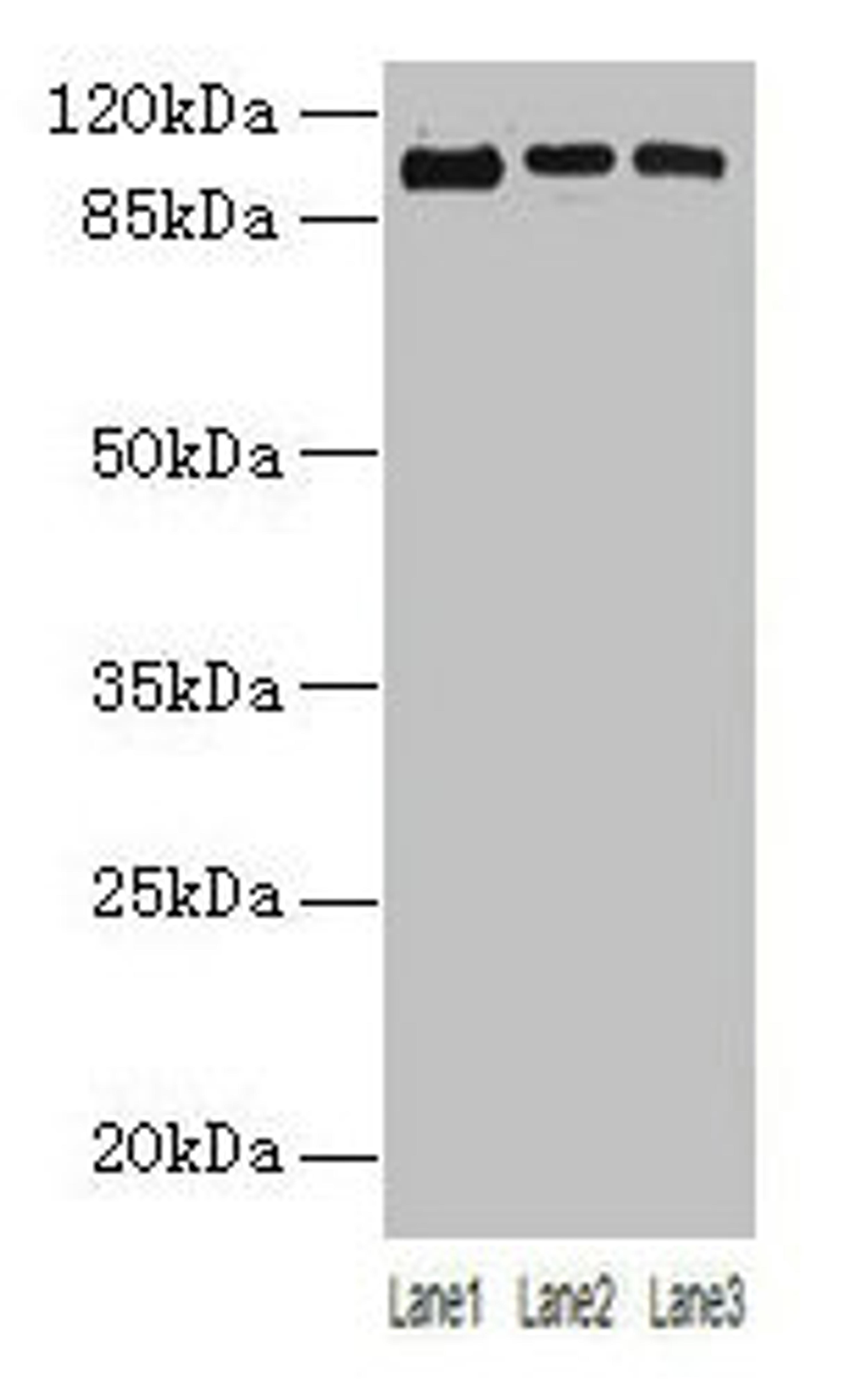 Western blot. All lanes: ZNF546 antibody at 4µg/ml. Lane 1: A549 whole cell lysate. Lane 2: 293T whole cell lysate. Lane 3: Hela whole cell lysate. Secondary. Goat polyclonal to rabbit IgG at 1/10000 dilution. Predicted band size: 99 kDa. Observed band size: 99 kDa