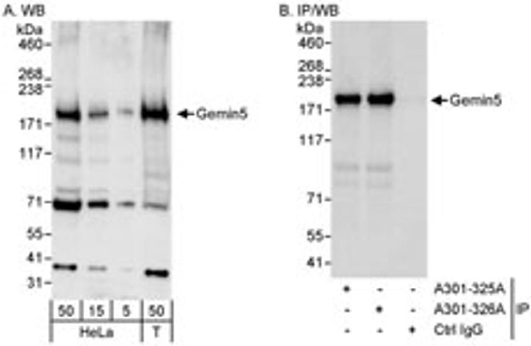 Detection of human Gemin5 by western blot and immunoprecipitation.